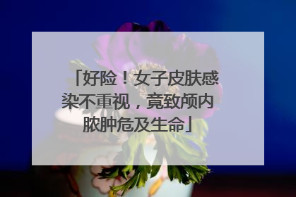 好险！女子皮肤感染不重视，竟致颅内脓肿危及生命